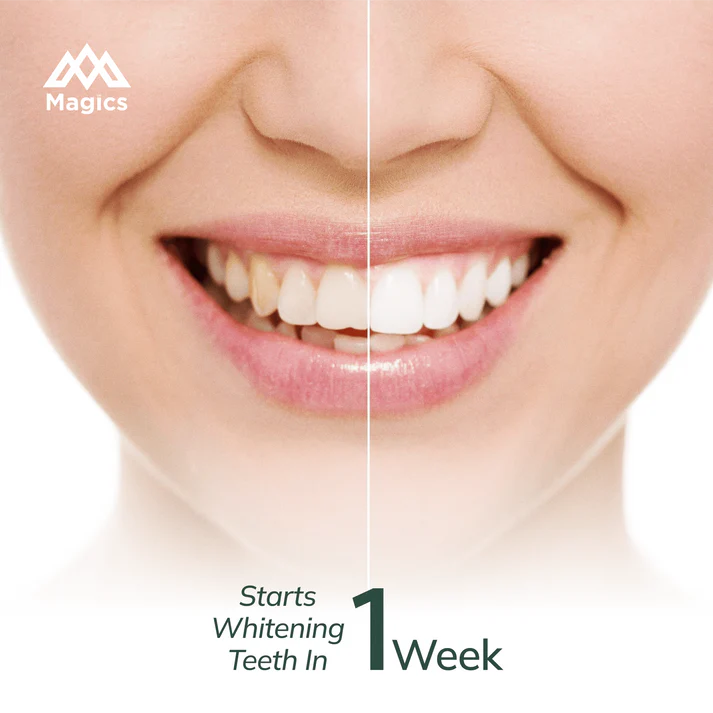 Magics PearlX Teeth Whitening Toothpaste ( Pack Of 2 ) | 100 gms each