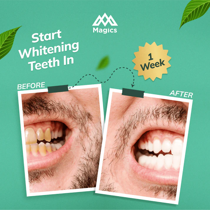Magics PearlX Teeth Whitening Toothpaste ( Pack Of 2 ) | 100 gms each