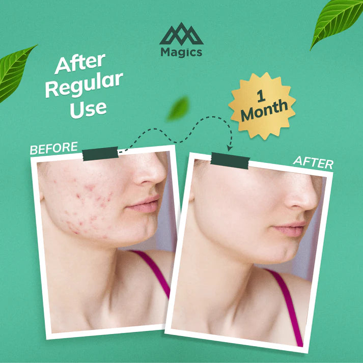 Magics Care Face Soap | ( Pack Of 2 )